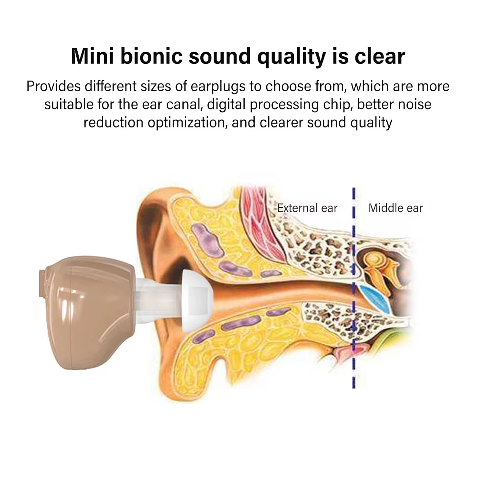 Mini amplificateur de son, rehausseur de son d'oreille, réduction du bruit, annulation améliorée du retour vocal, adapté aux adultes âgés et aux enfants