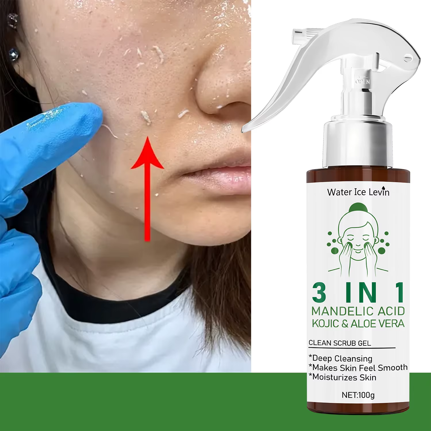 Gel exfoliant 3 en 1 Mandelic Acid & Kojic Clean à l'aloe vera – Nettoyage en profondeur et hydratant pour une peau lisse et sûre