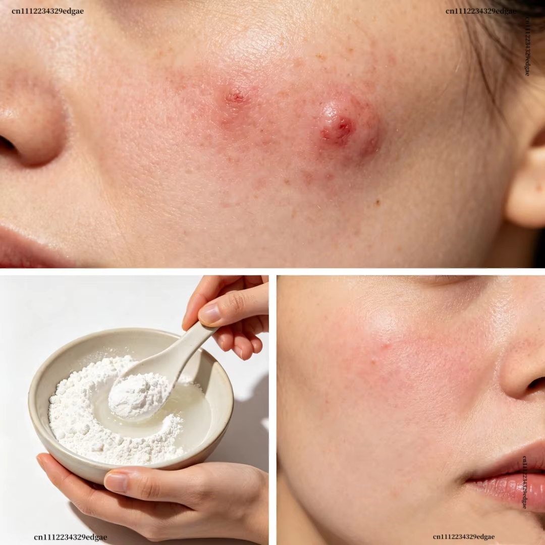 Poudre d'acide salicylique à 99 % pour la fabrication artisanale de savon cosmétique DIY, matière première pour savon de bain et parfums faits maison