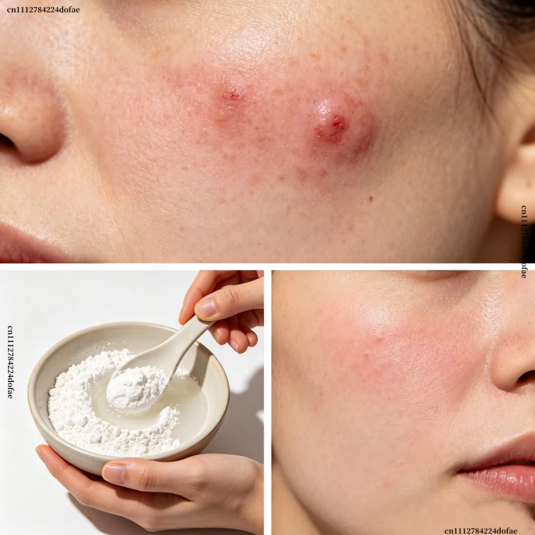 Poudre d'acide salicylique à 99 % pour la fabrication artisanale de savon cosmétique DIY, matière première pour savon de bain et parfums faits maison