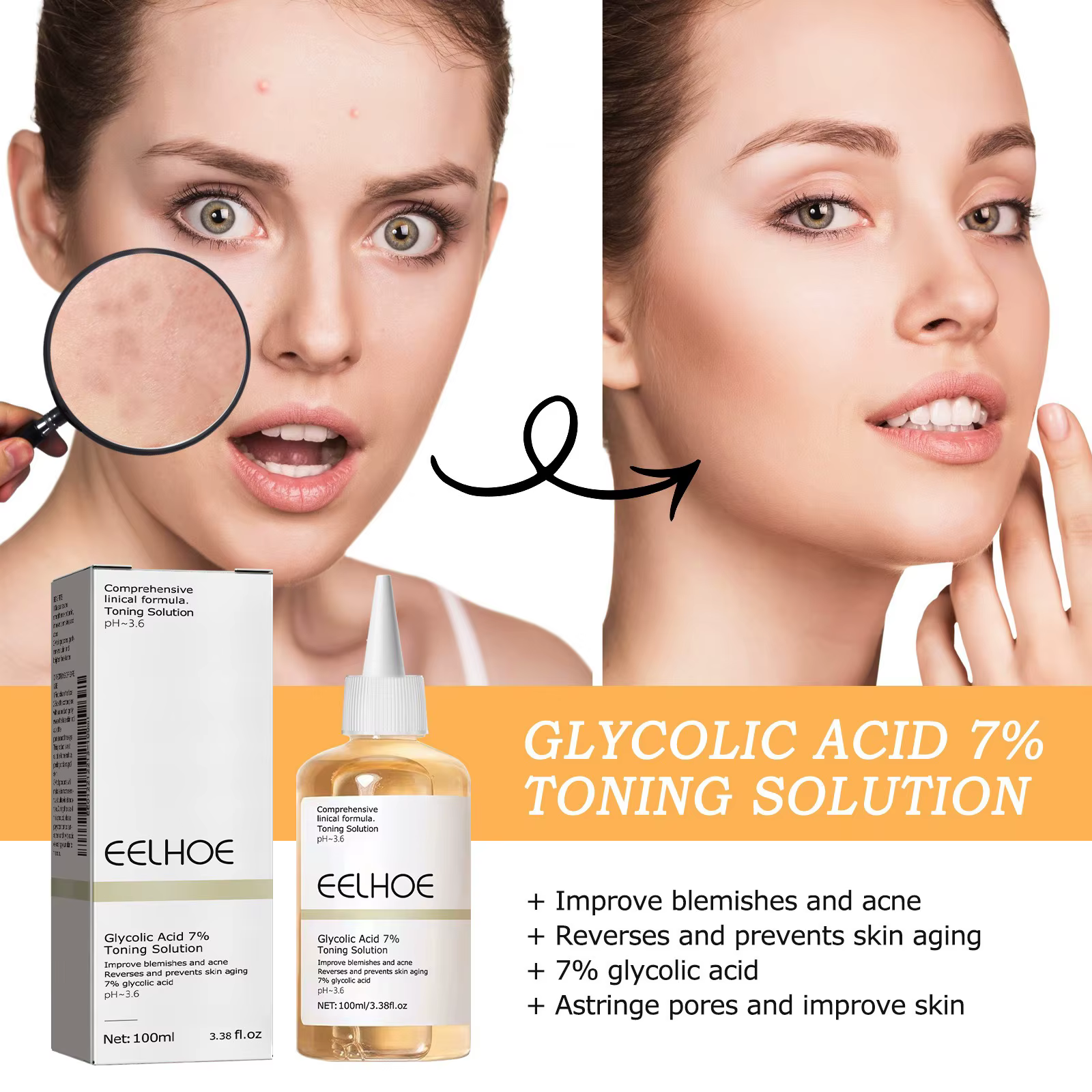 Solution tonifiante à l'acide glycolique 7%, dissolvant d'acné ordinaire, Lifting, raffermissant, rides, brillant, soins pour la peau du visage, Toner à l'acide glycolique