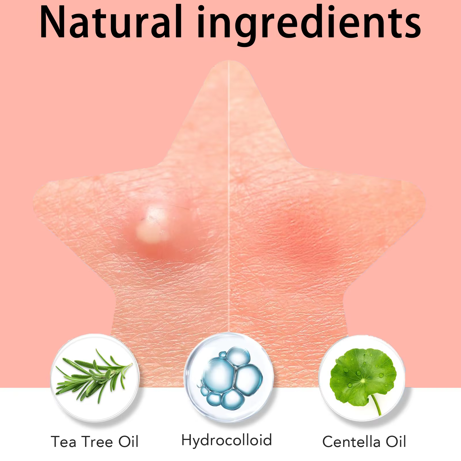 1008/504 pièces/boîte de patchs d'acné, autocollants d'acné non irritants, patchs d'acné d'acide salicylique et d'huile d'arbre à thé de haute qualité