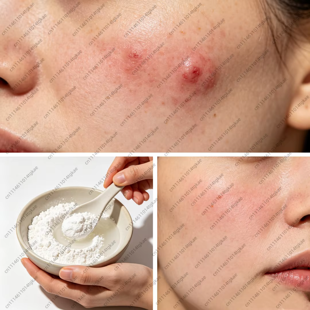 Poudre d'acide salicylique à 99 % pour la fabrication artisanale de savon cosmétique DIY, matière première pour savon de bain et parfums faits maison